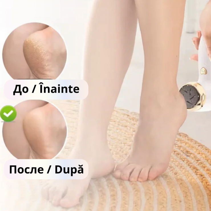 Пилка для пяток Storm Foot Grinder